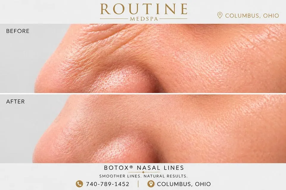 Before and After Treatment d