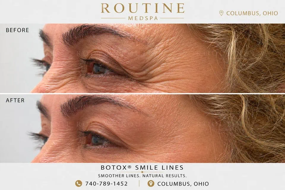 Before and After Treatment e