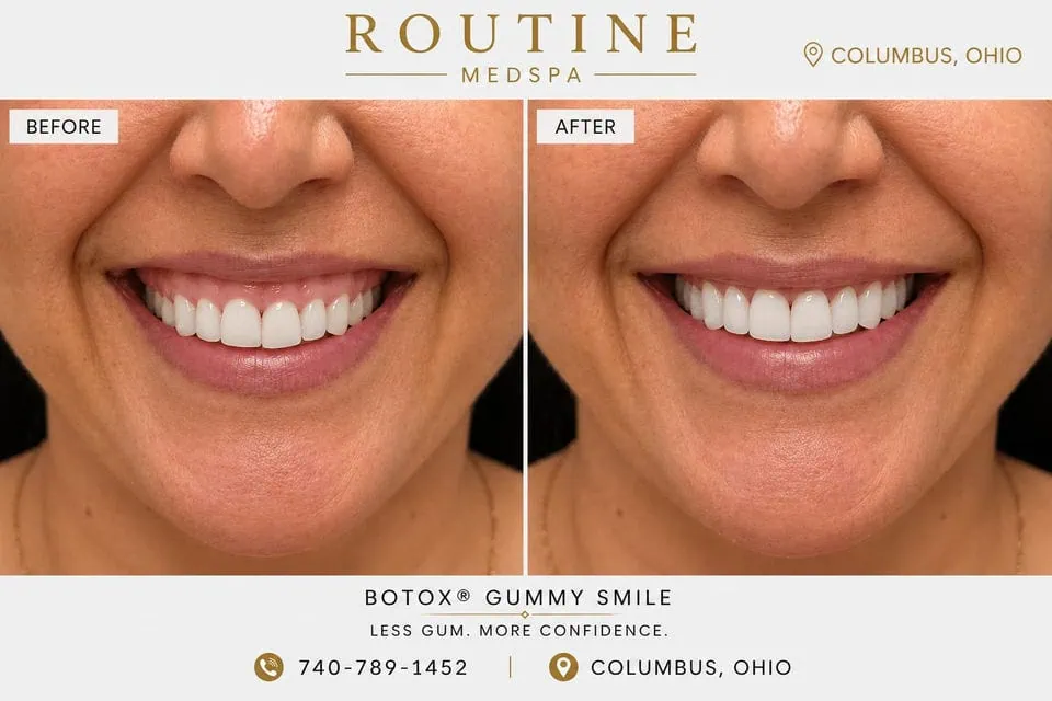 Before and After Treatment f