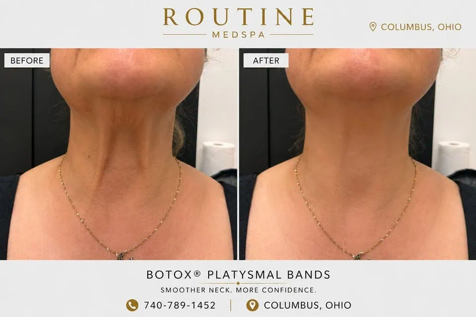 Before and After Treatment